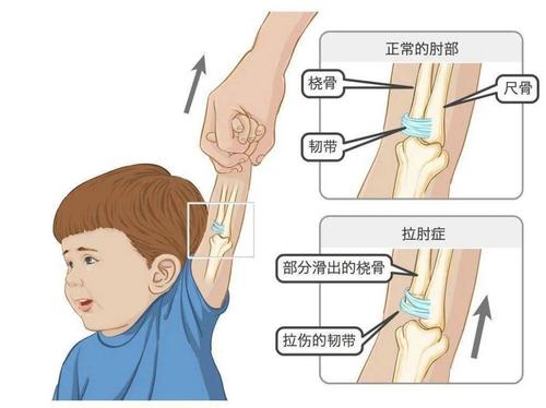 博德之门3如何治疗肩膀脱臼-肩膀脱臼治疗方法一览