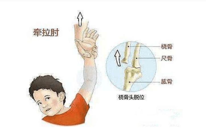 博德之门3如何治疗肩膀脱臼-肩膀脱臼治疗方法一览